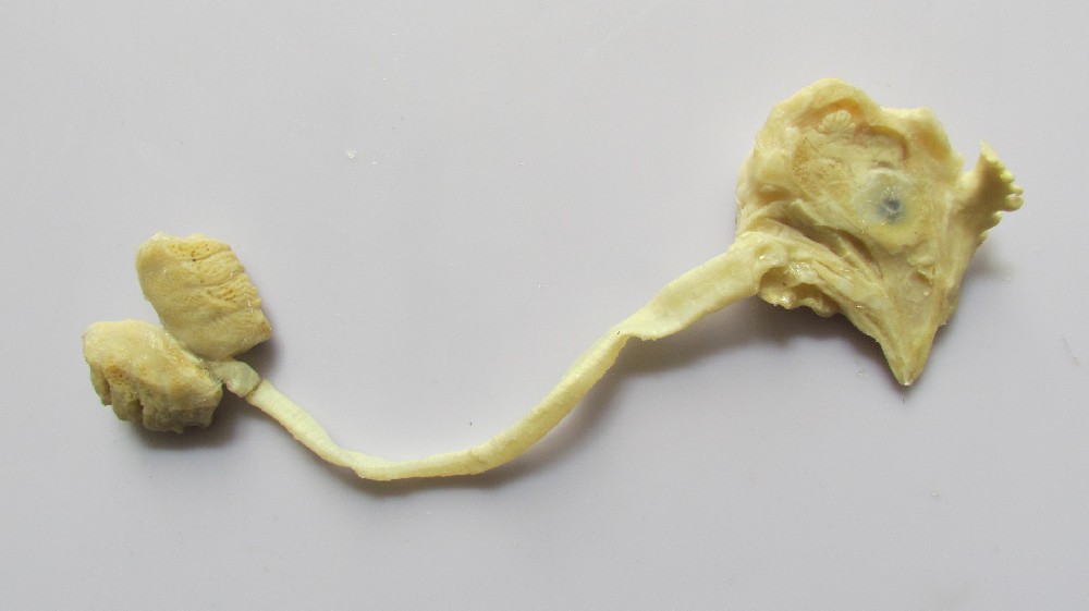 雞消化系統(tǒng)